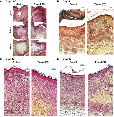 Potential Mechanism of Dermal Wound Treatment With Preparations From the Skin Gel of Arabian Gulf Catfish: A Unique Furan Fatty Acid (F6) and Cholesta-3,5-Diene (S5) Recruit Neutrophils and Fibroblasts to Promote Wound Healing